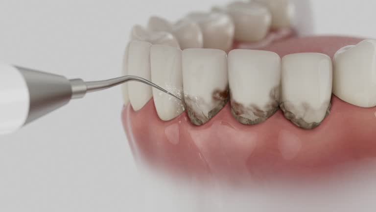 Reliable Dental Implants contractor in Finley, WA by Smile Center Dentistry